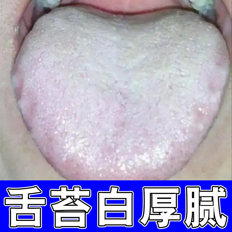 舌苔白厚舌头有裂纹口臭口千调理肠胃脾胃厚腻调理脾胃健