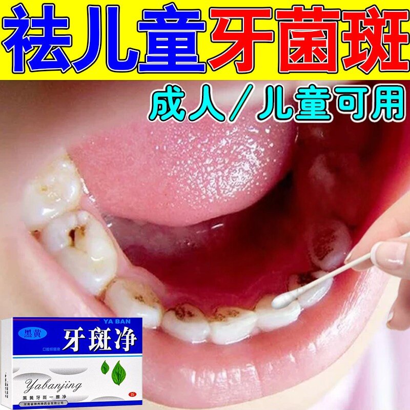 儿童牙齿黑斑除牙菌斑黑牙黄牙垢洗牙剂神器去黑线黑渍牙窝牙斑净