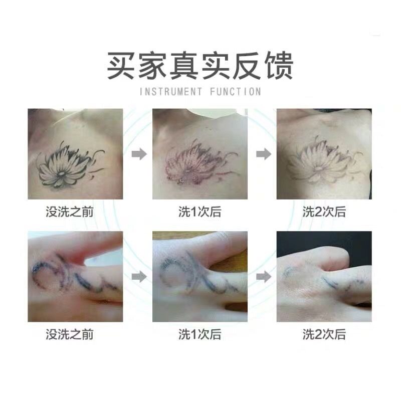 皮秒激光祛斑仪器小型洗眉机点痣笔去黑色素胎记痘印洗纹身神器