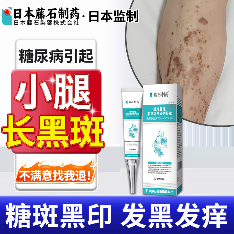 日本糖尿引起小腿黑斑胫前糖斑腿发黑烂足伤口愈合祛腐药房同售xu