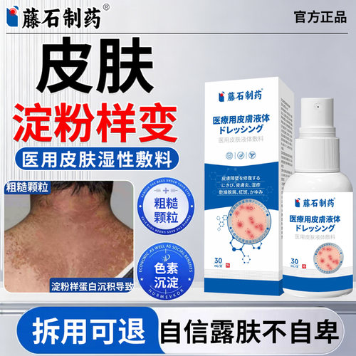 皮肤淀粉样变专特用顽固后背大小腿黑色素皮肤粗糙可搭止痒药膏XP