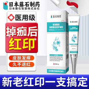 掉痂后红印修复疤痕摔伤擦伤结痂止痒淡化消印促愈祛除药房同售xu