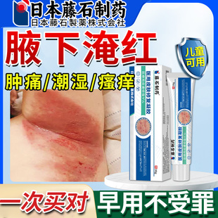防腋下淹红腋窝出汗胳肢窝肿痛潮湿瘙痒淹了防淹喷剂膏药监备案pr