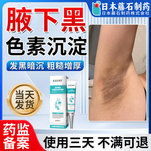 腋下黑色素沉淀医用凝胶去除美白腋窝咯吱窝黢黑药房同售xu