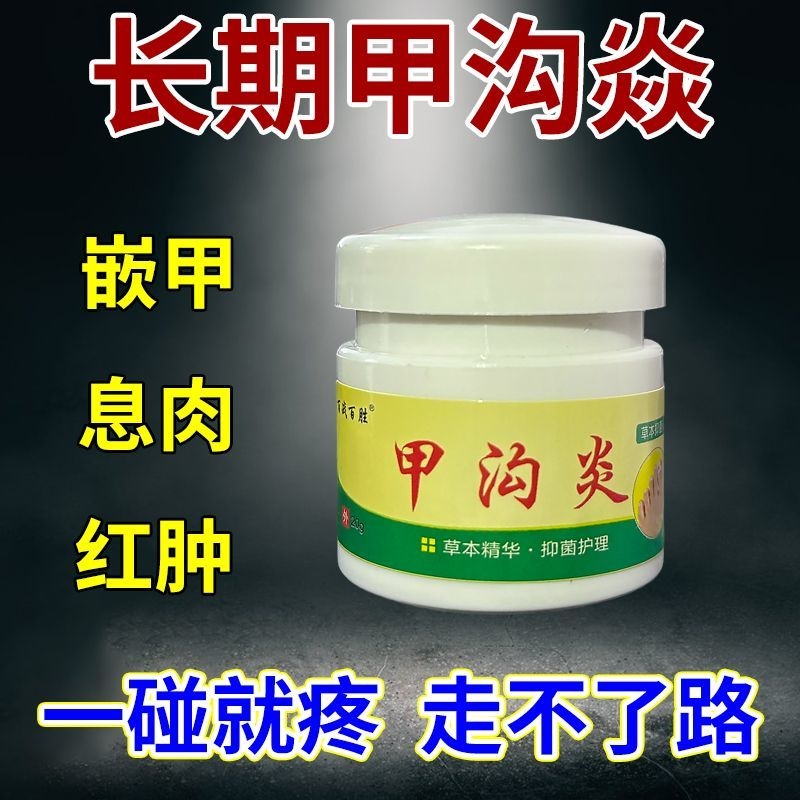 甲沟焱脚指甲疼大拇指往肉里长销肿感染发焱红肿化脓脚指甲止痛膏