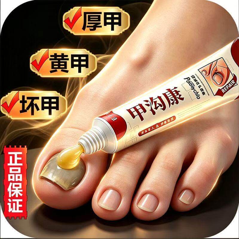 甲沟康指甲修护膏足部可用脚趾甲发黄变色凹凸不平外用清洁养护膏