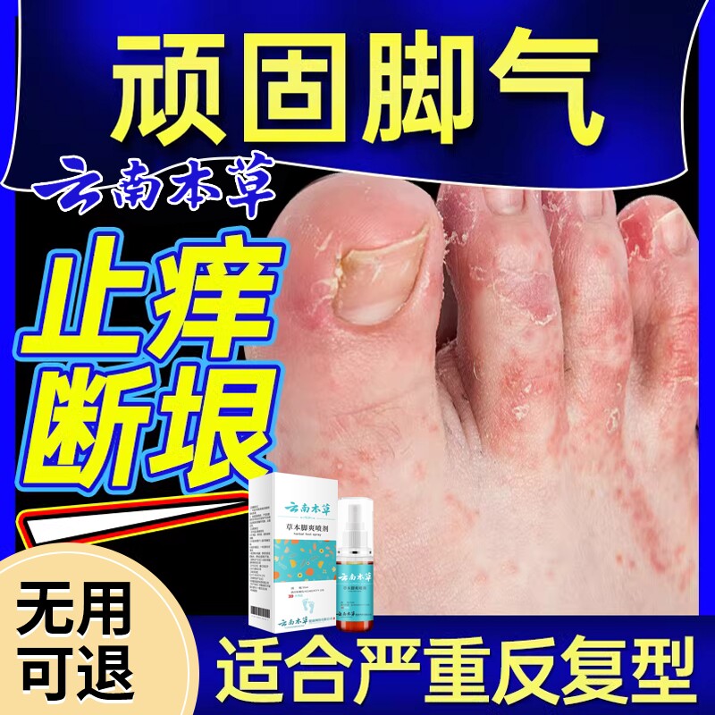 云南本草脚气止痒脱皮杀菌喷雾剂正品除臭专用根去烂脚丫水泡草本