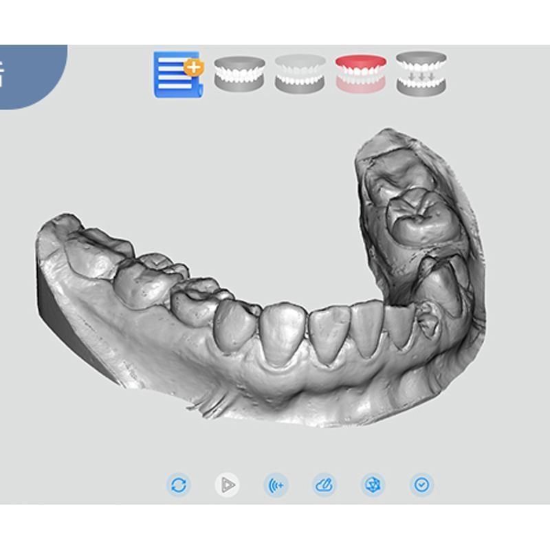 抖音义齿  齿科扫描仪 种植 牙模 珠宝G 核雕 耳模三维扫描仪