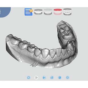 牙模 种植 珠宝G 核雕 抖音义齿 耳模三维扫描仪 齿科扫描仪
