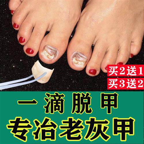 极速甲郎中灰指甲特效灰甲净治灰c甲亮甲去除灰指甲脱甲液增厚灰