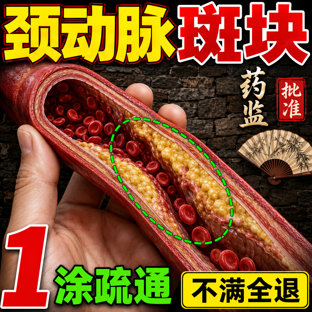 颈动脉斑块消除脑供血不足头晕药