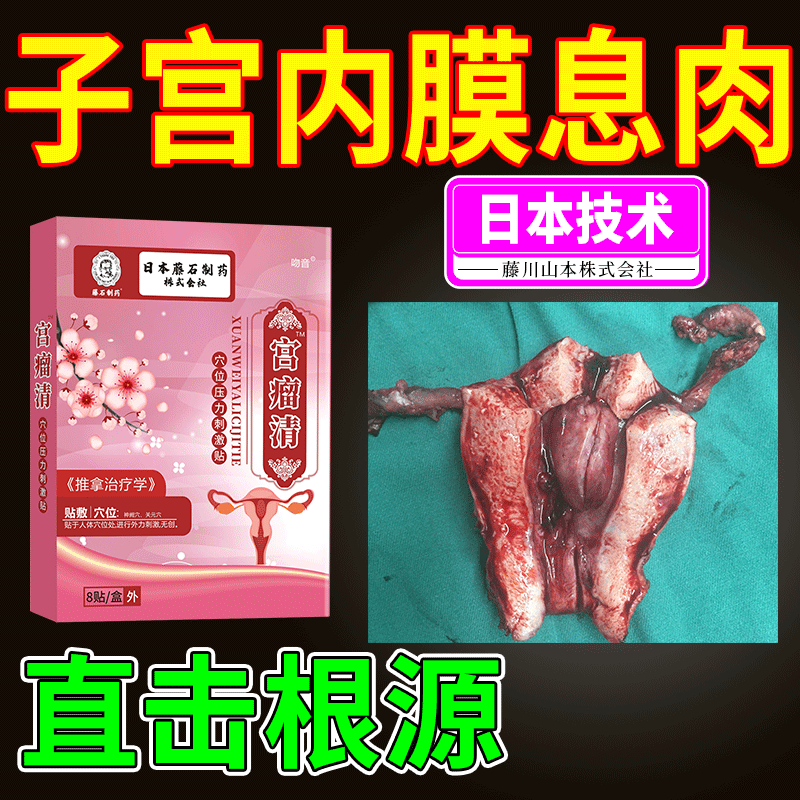 治疗子宫内膜息肉的中药贴月经失调药...