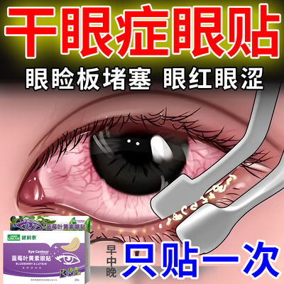 干眼症热敷治疗蒸汽眼罩医用缓解眼疲劳雾化仪治疗干眼症的药DK
