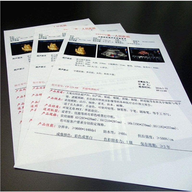 医院用胶片瓷白喷墨片胶q片A4胶片胃镜B超四维彩超打印纸100张