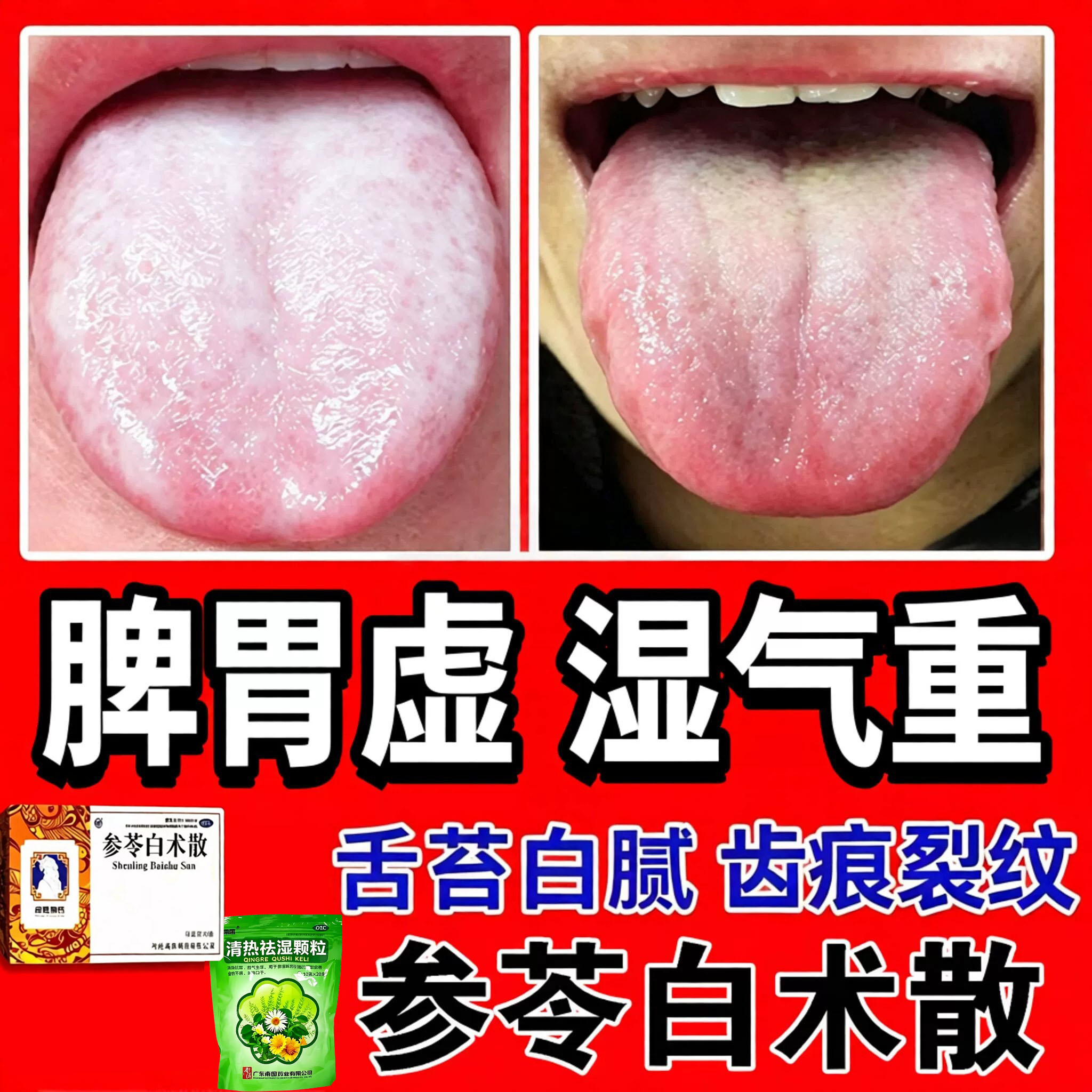 [向前]参苓白术散6g*10袋/盒