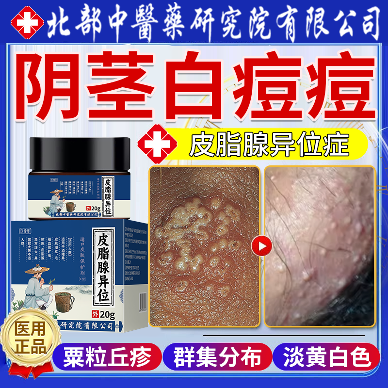 阴茎白痘痘包皮疙瘩小点脂肪粒皮脂腺异位症白点龟头阴囊瘙痒vp