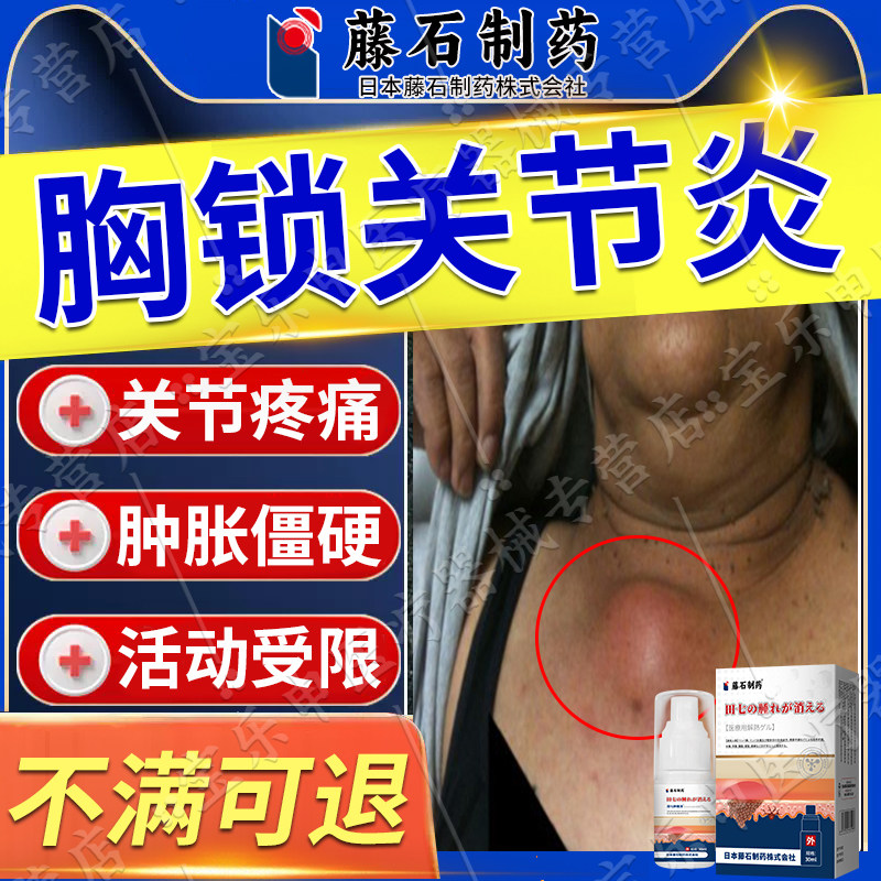 胸锁骨内侧肿胀按压疼痛胸锁关节炎消肿止痛专用膏可搭配膏药贴vp
