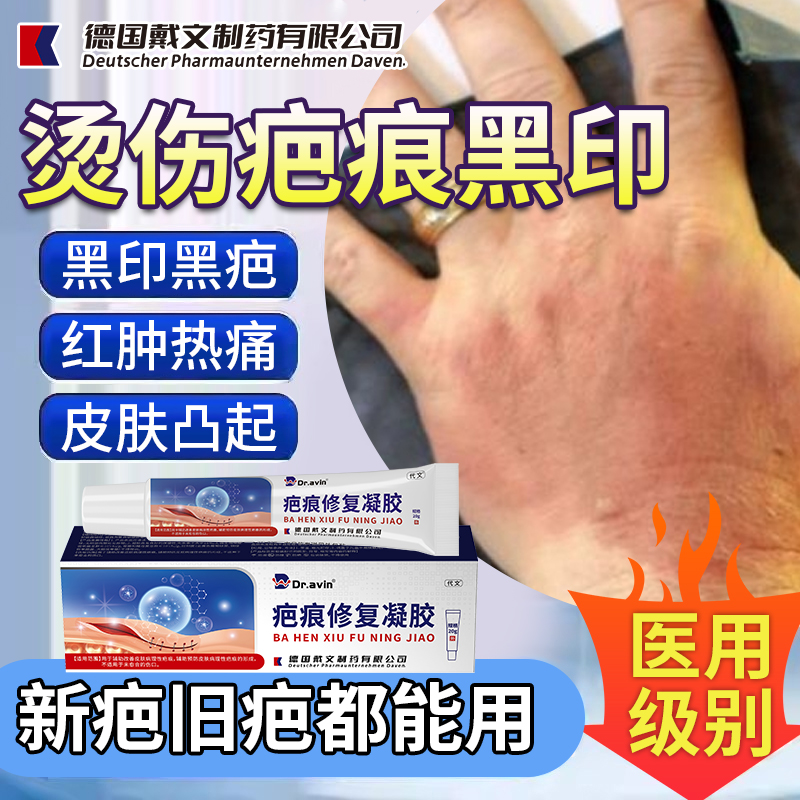 【代文】烫伤疤痕黑印药膏