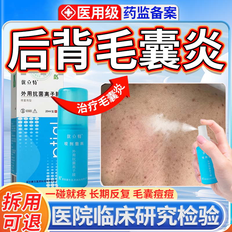 医用毛囊炎抗菌喷剂（临床检验）