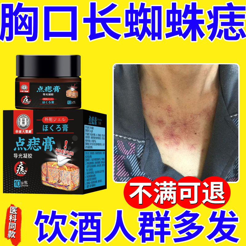 去胸前蜘蛛痣全身红痣血管痣成年男女可用华东点痣膏qi