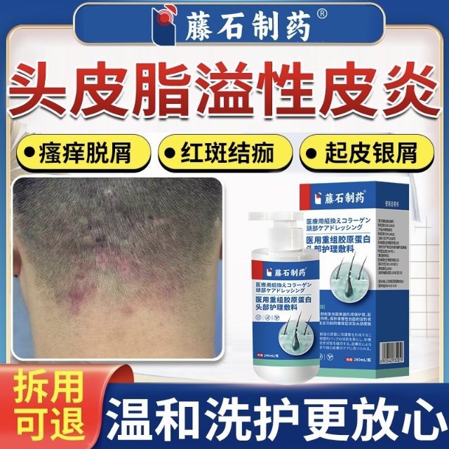 【藤石制药】头皮皮炎洗发水