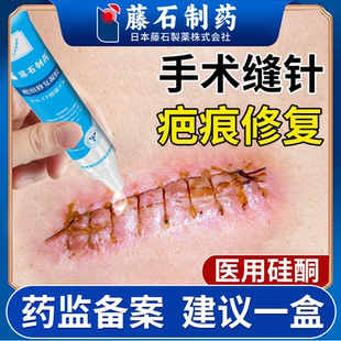去专除手术缝针疤痕修复祛去疤膏手术伤口刀口祛疤恢复贴用VP