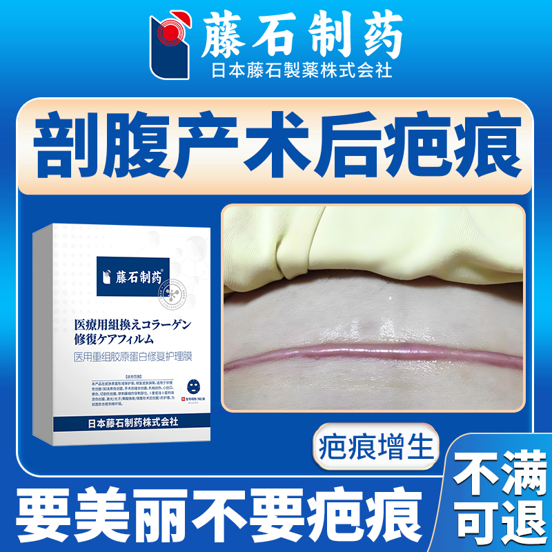 疤痕剖腹产手术后伤疤修疤痕膏复专疤痕增生用贴小孩子QI
