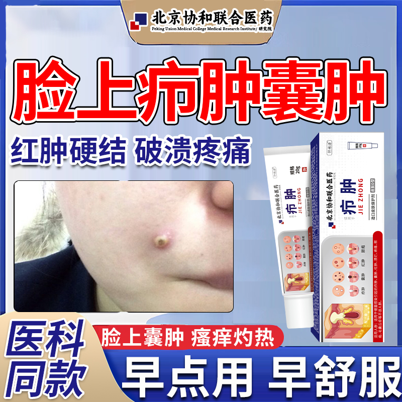 脸上长疖肿疙瘩囊肿痘痘溃烂瘙痒流脓疼痛专火毒疖子用疖肿膏qi