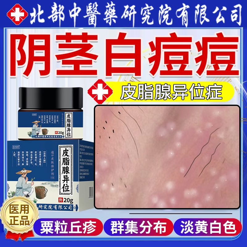 阴茎白痘痘包皮疙瘩小点脂肪粒皮脂腺异位症白点龟头阴囊瘙痒vp