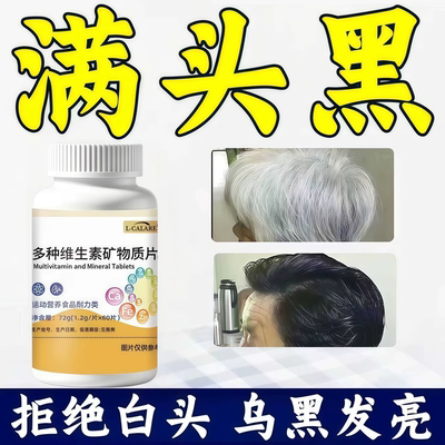 赋格方维生素黑发少中老年白发滋养发根滋生改善白发固发乌丝