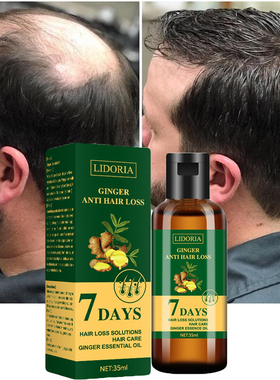 极速Ginger Hair Growth Essvential Oil Natural Anti Hair Loss