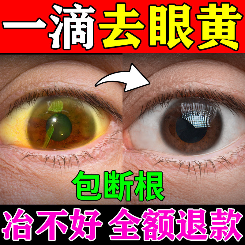溴芬酸钠滴眼液叙清cisen/辰欣 溴芬酸钠滴眼液