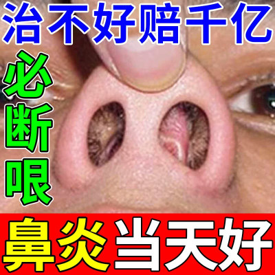 盐酸羟甲唑啉喷雾剂喷剂鱼牌过敏性鼻炎喷鼻鼻塞流鼻涕鼻窦炎