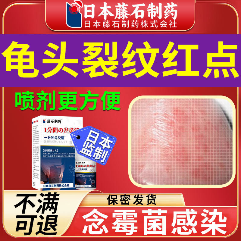 日本男性龟头炎裂口纹红肿上有小红点瘙痒包皮炎症专用开裂发炎hv