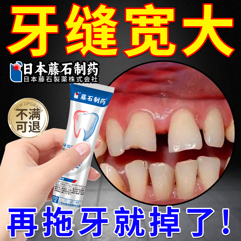 牙齿敏感导致牙龈萎缩牙缝宽大