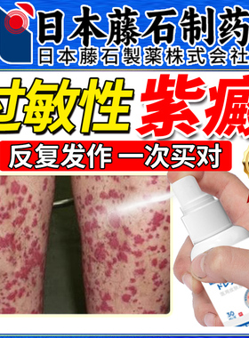 过敏性紫癜疗色素皮下出血红点瘀皮炎血管炎儿童药监备案OM