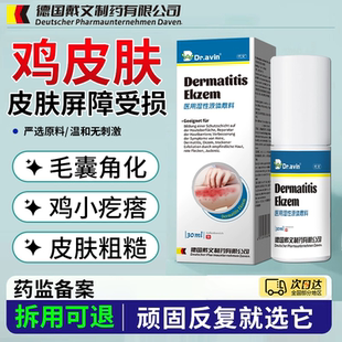 鱼鳞病皮肤霜蛇皮肤专用膏干燥起皮去鸡皮身体乳保湿药房同售HB