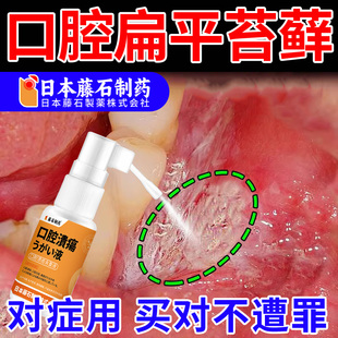 口腔扁平苔藓专用喷剂溃疡口疮白斑充血黏膜修复液医用正品OM