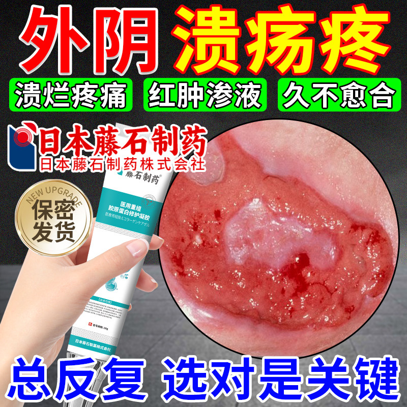 藤石制药外阴溃疡私处破皮粘膜溃破疼痛白斑瘙痒疱疹有小疙瘩膏OM