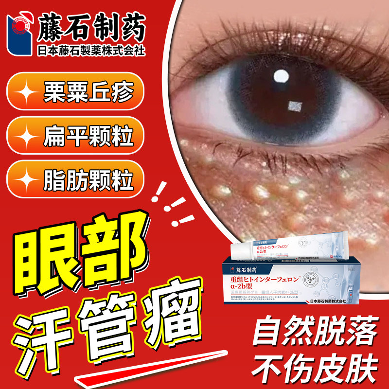 日本眼部汗管瘤专用药膏去除神器脂肪粒扁平疣去祛眼周栗粟丘疹hv