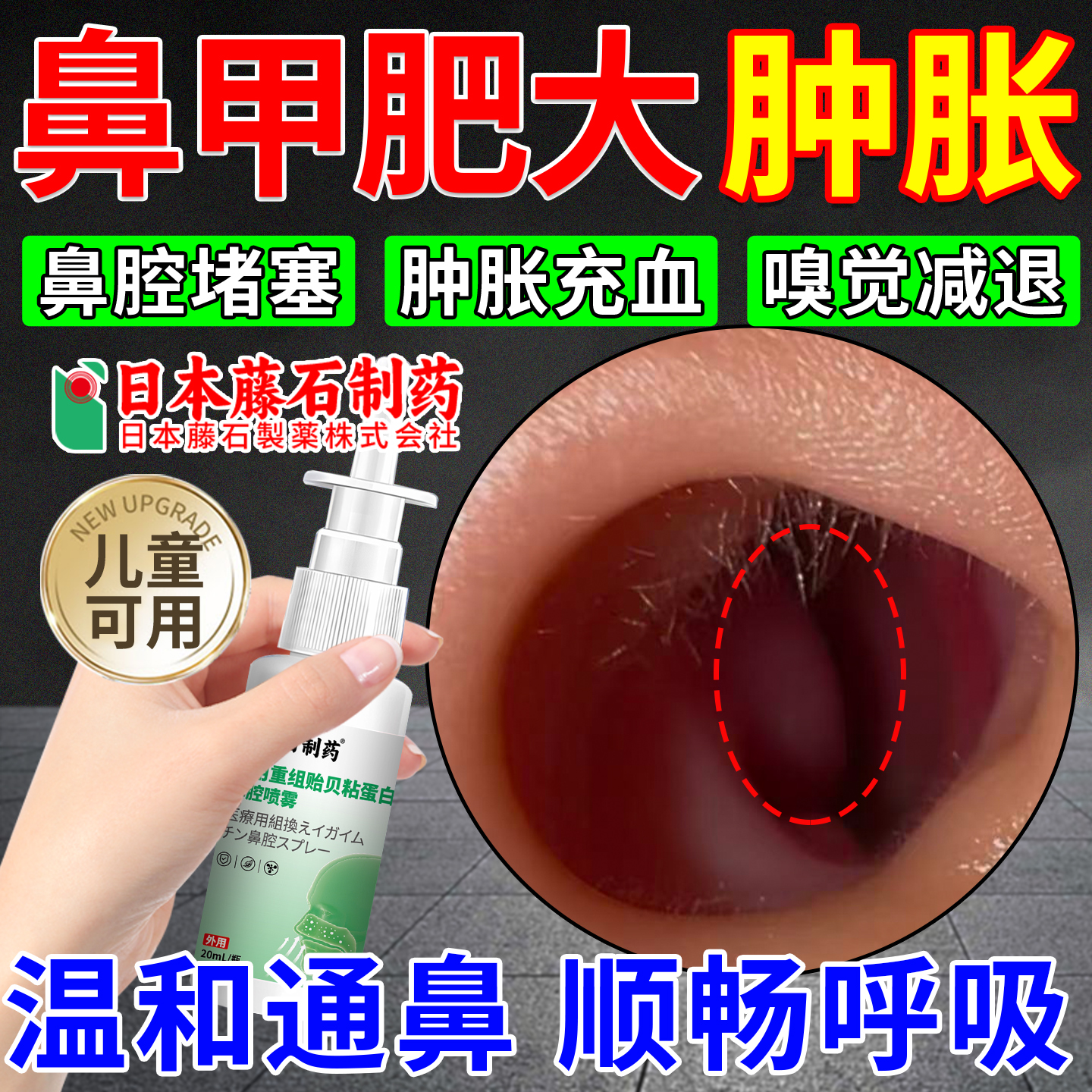 鼻甲肥大肿胀专用喷剂特消炎修复效儿童鼻炎鼻塞通气可搭膏药贴OM