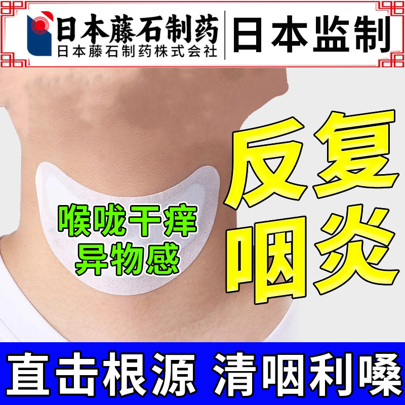 咽喉炎专用贴慢性咽炎除根喉咙发炎肿痛干痒有异物感药房同售OM