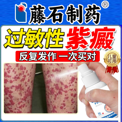 藤石制药过敏性紫癜喷剂