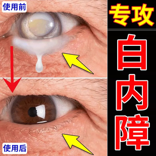 苄滴眼液老年性白内障视力下降视物模糊对比敏感度下降