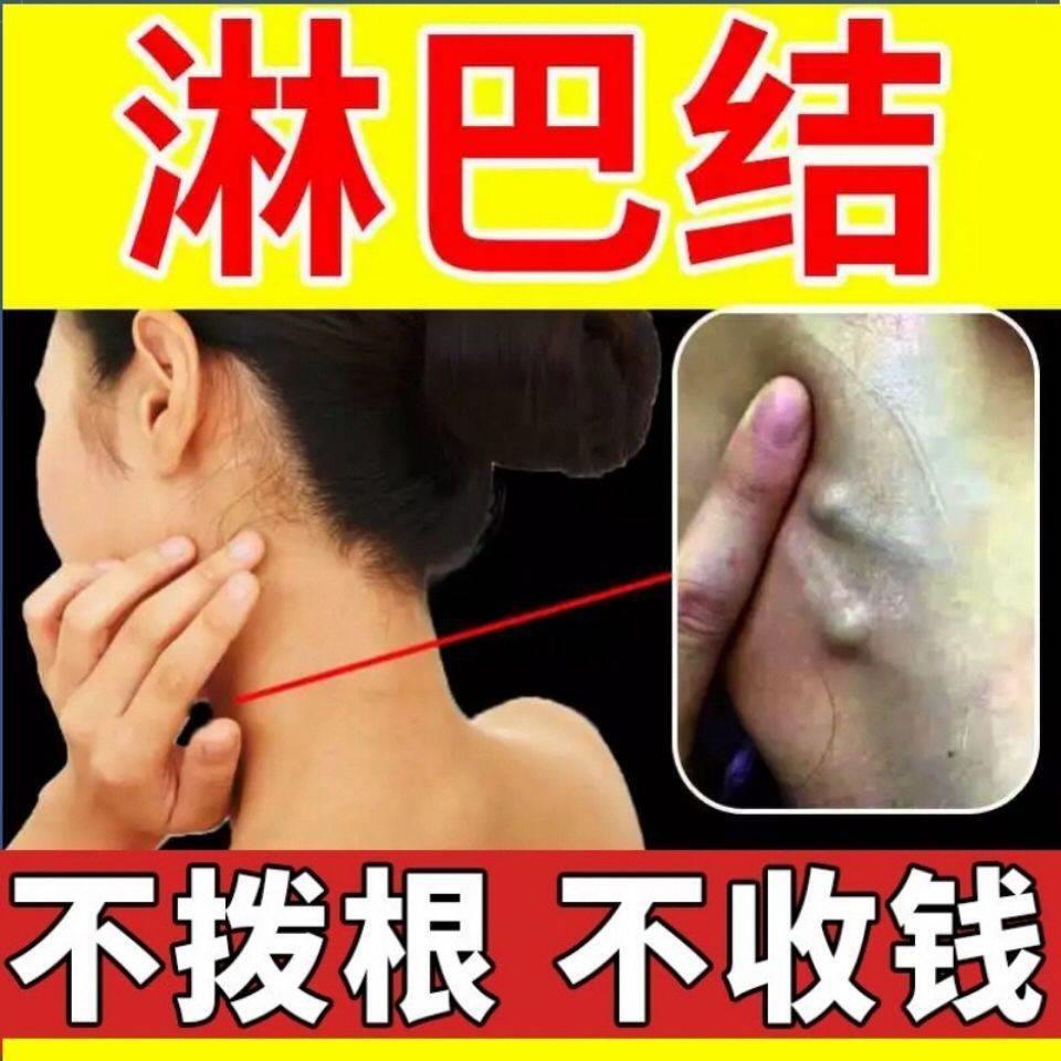 速发淋巴散结膏脖子肿大消贴颈部结节耳后疏通腹股沟腋窝收副乳神