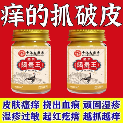 藏药蝎毒王】牛皮癣银屑药膏止痒头癣手足癣皮炎湿疹牛皮癣止痒膏