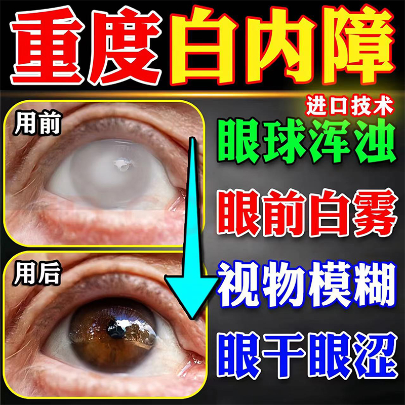 甲纤维素滴眼液润洁博士伦蔡敏维眼药水包邮润洁萘敏维