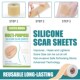 Silicone Scarz Tape 极速1 Sheets 150cm Scar For 2pcs Skin