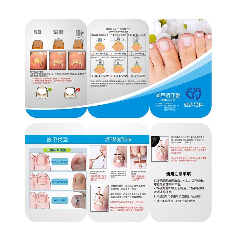 极速不锈钢嵌甲矫正m器套装 甲沟指甲卷甲修正器 脚趾甲拉拉物理,彩妆/香水/美妆工具,美甲工具,淘宝优惠券,粉丝福利购,淘宝优惠卷