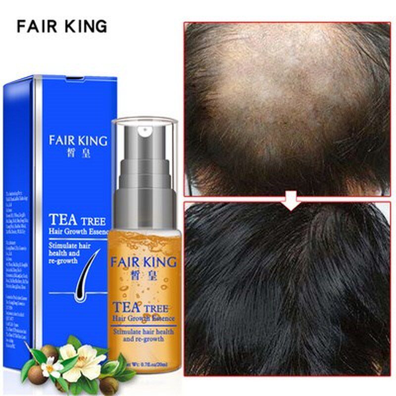 极速Hair Growth Essences Tea Tree Re-Growth women men anti l